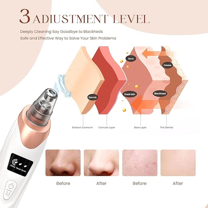 5-in-1 Blackhead Remover Machine