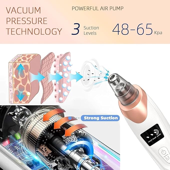 5-in-1 Blackhead Remover Machine